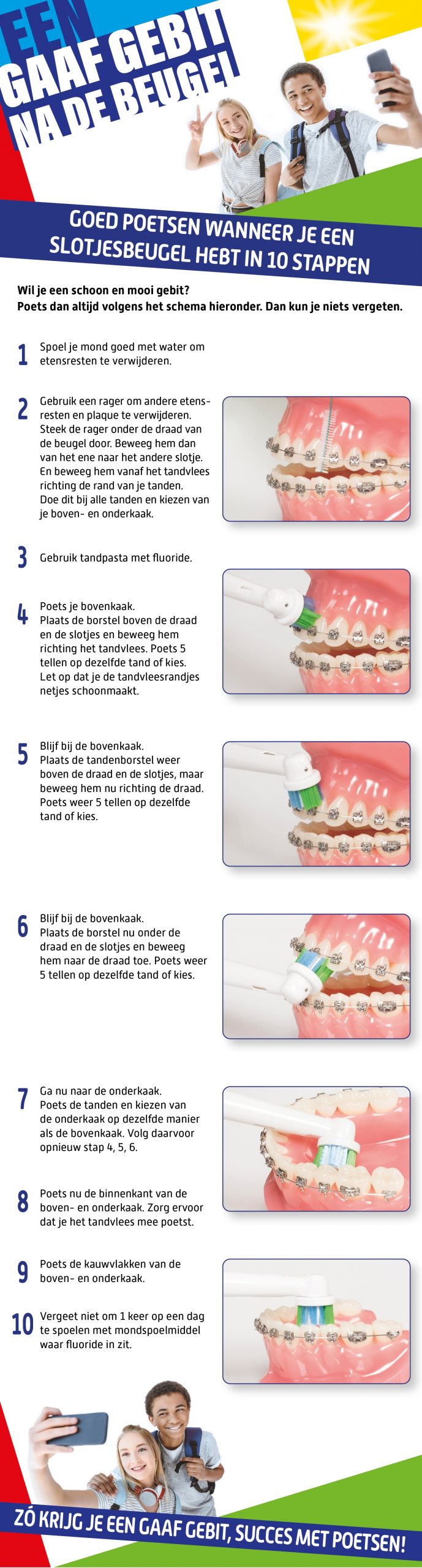 Poetsinstructie Elektrisch Poetsen